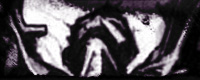 dsm_indignation thumb